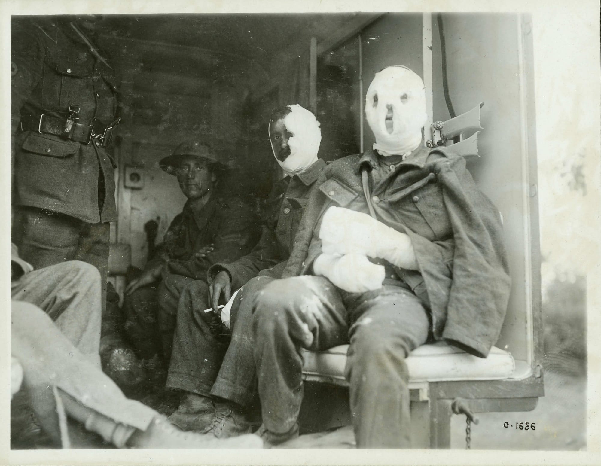 Battles and Fighting Photographs - Mustard Gas Victims | Canada and the First World War Battles and Fighting Photographs - Mustard Gas Victims | Canada and the First World War