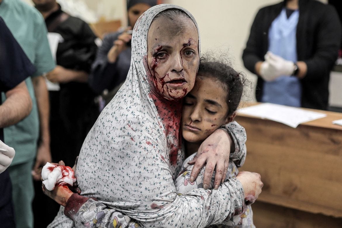 An injured Palestinian woman covered in dust and blood hugs an injured girl child at the hospital following the Israeli bombardment of Khan Yunis in the southern Gaza Strip. An injured Palestinian woman covered in dust and blood hugs an injured girl child at the hospital following the Israeli bombardment of Khan Yunis in the southern Gaza Strip.