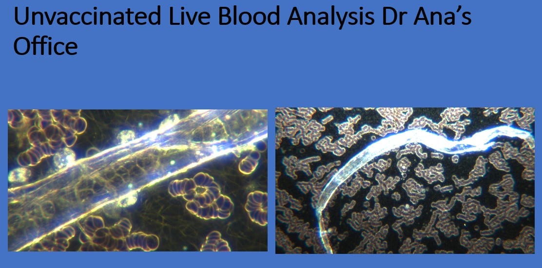 Ugh! What Blood Analysis Showed in Our Grocery Meat Products Ugh! What Blood Analysis Showed in Our Grocery Meat Products