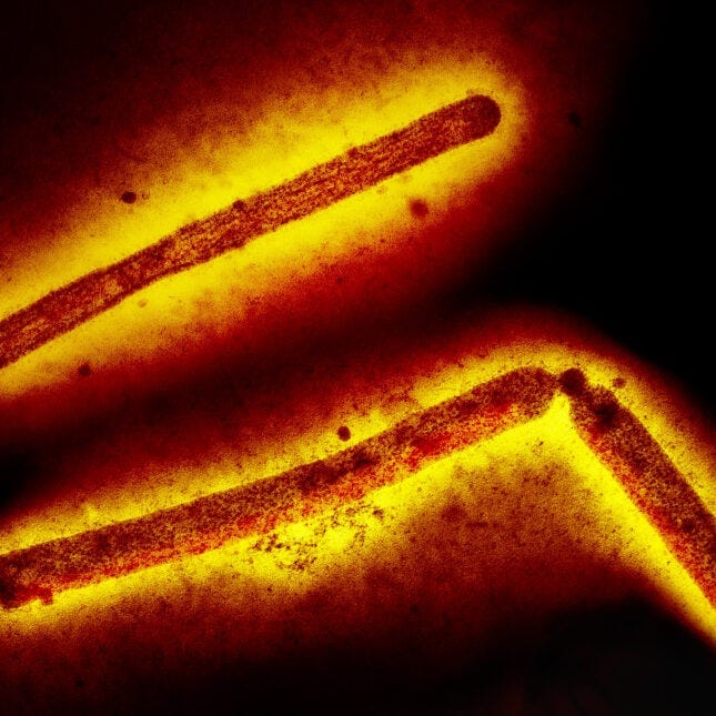 Three influenza A (H5N1, bird flu, avian flu) virus particles (rod-shaped). Note: Layout incorporates two CDC transmission electron micrographs that have been inverted, repositioned, and colorized by NIAID. Scale has been modified. Three influenza A (H5N1, bird flu, avian flu) virus particles (rod-shaped). Note: Layout incorporates two CDC transmission electron micrographs that have been inverted, repositioned, and colorized by NIAID. Scale has been modified.