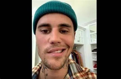 cranial nerve vii justine bieber cranial nerve vii justine bieber