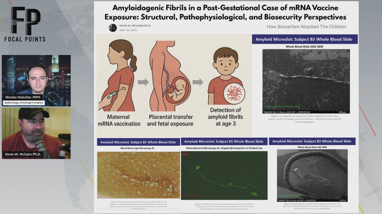 BREAKING: Prion-Like Amyloid Fibrils Found in 3-Year-Old Born Lifeless After In-Utero Pfizer mRNA Injection Exposure BREAKING: Prion-Like Amyloid Fibrils Found in 3-Year-Old Born Lifeless After In-Utero Pfizer mRNA Injection Exposure