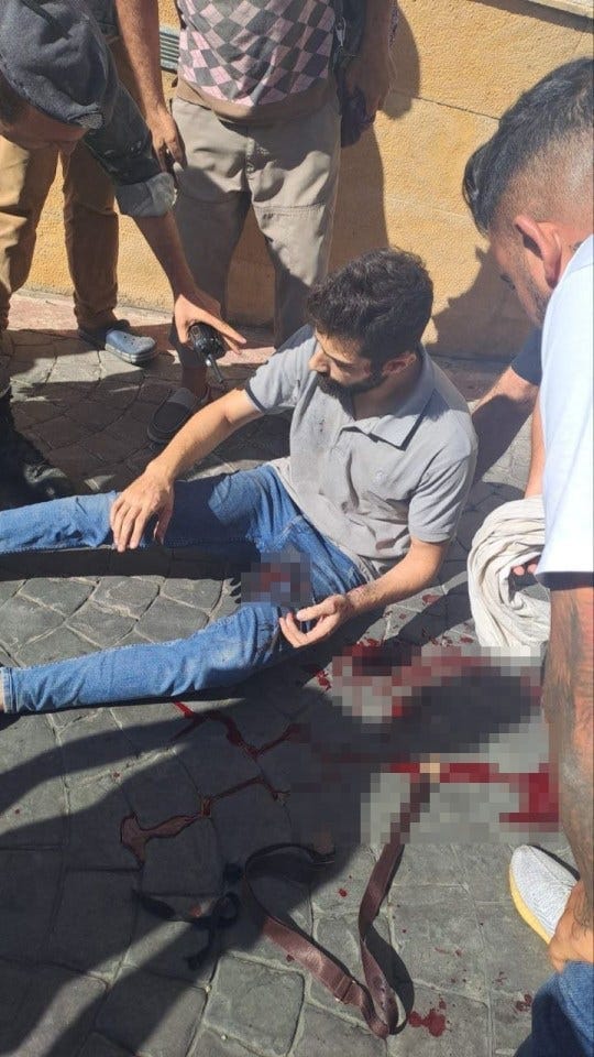 A man pictured covered in blood after a pager in his pocket exploded A man pictured covered in blood after a pager in his pocket exploded