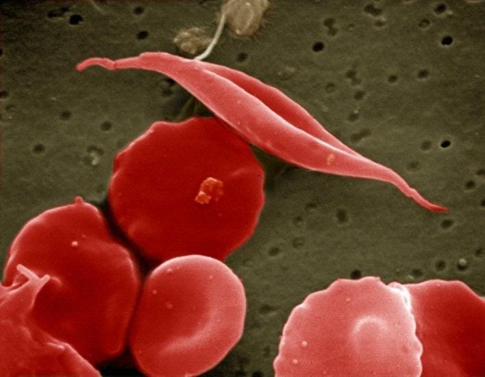 CRISPR gene editing reveals new therapeutic a | EurekAlert!