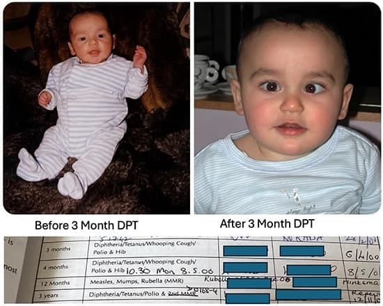 disabled after vaccination after 3 months disabled after vaccination after 3 months