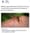 HORROR SHOW UPDATE 2: Are GMO Mosquitos The Reason Florida Issued Statewide Emergency Malaria Alert?
