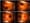 20,000% Increase in Retinal Eye Damage Following COVID-19 Vaccination